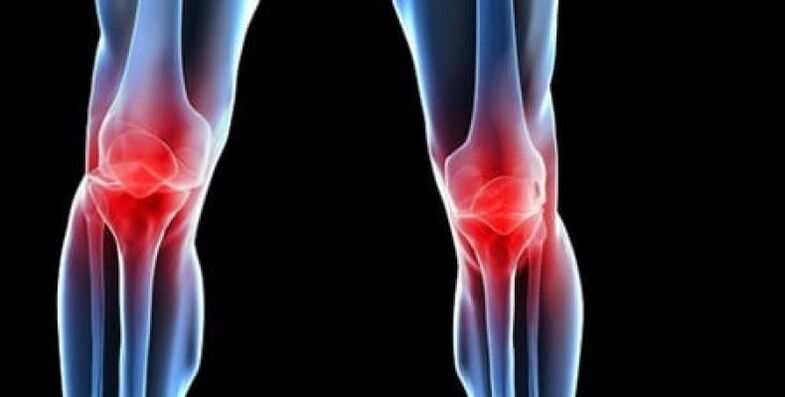 osteoartrite do joelho