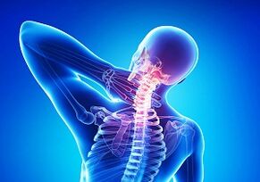 Complicações prováveis ​​com uma junção de osteocondrose