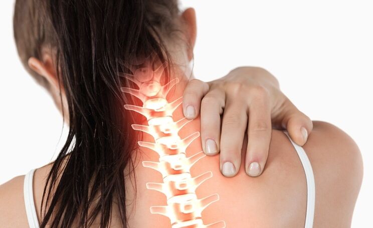 A osteocondrose cervical é caracterizada por tensão e dor no pescoço