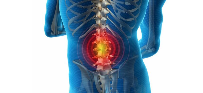 métodos para diagnosticar dor nas costas